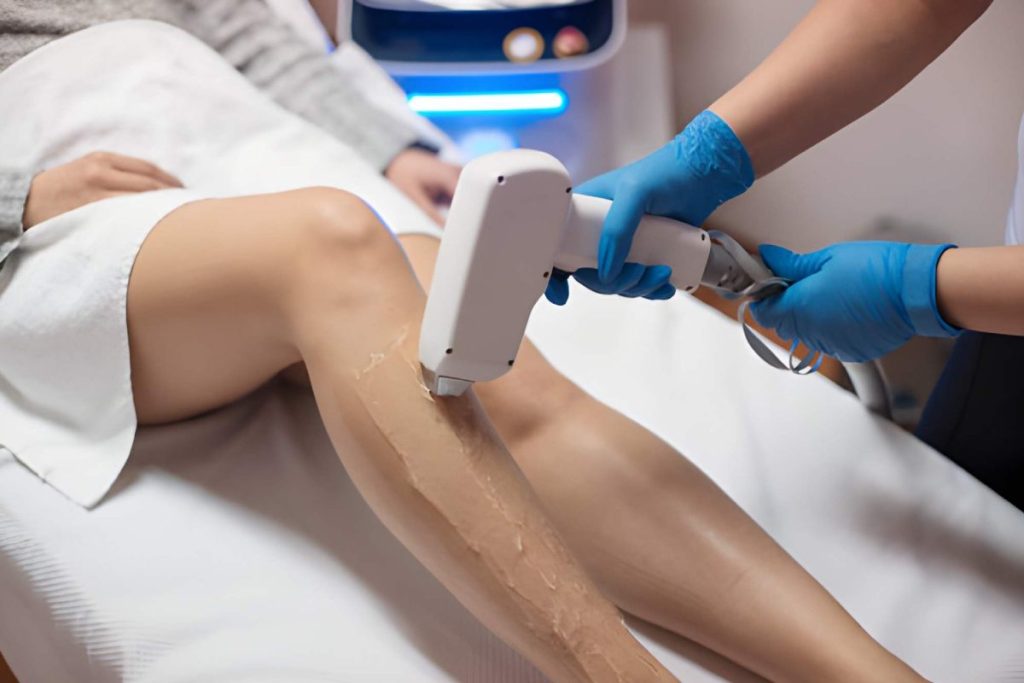 Laser Hair Removal